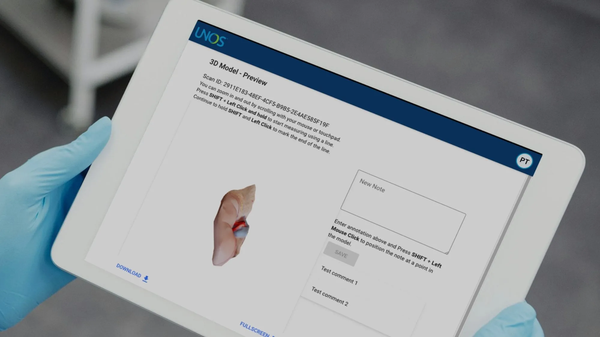 A clinician in gloves holding a tablet that shows a 3D organ model with an annotation box and measurement instructions.