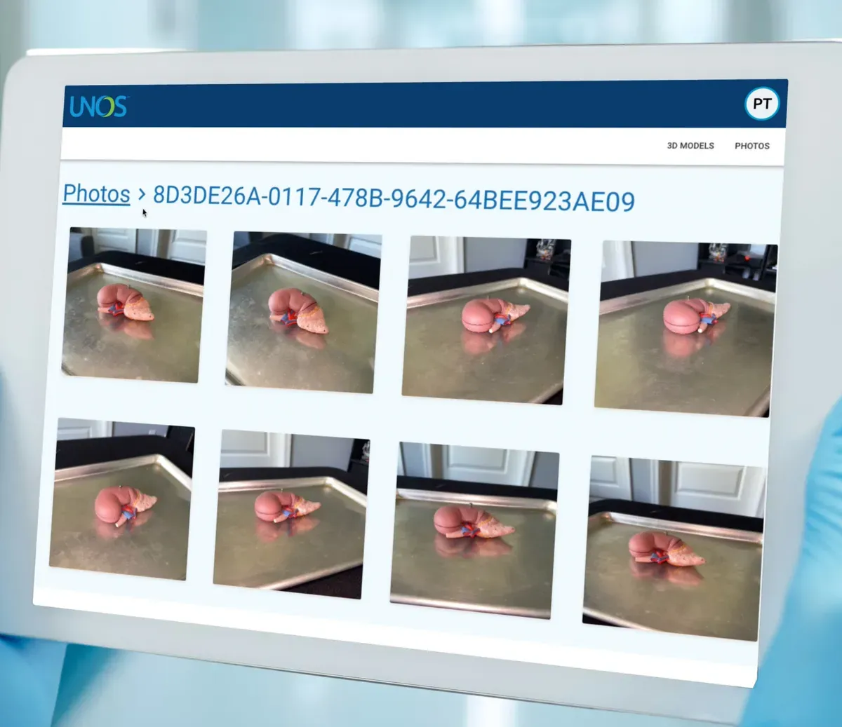 The web viewer on a tablet, showing a grid of photos captured for one organ scan from different angles.